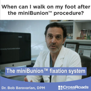 When can I walk on my foot after the minibunion procedure?